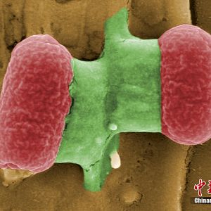 德国大肠杆菌疫情蔓延，西班牙进口黄瓜为传染源之一